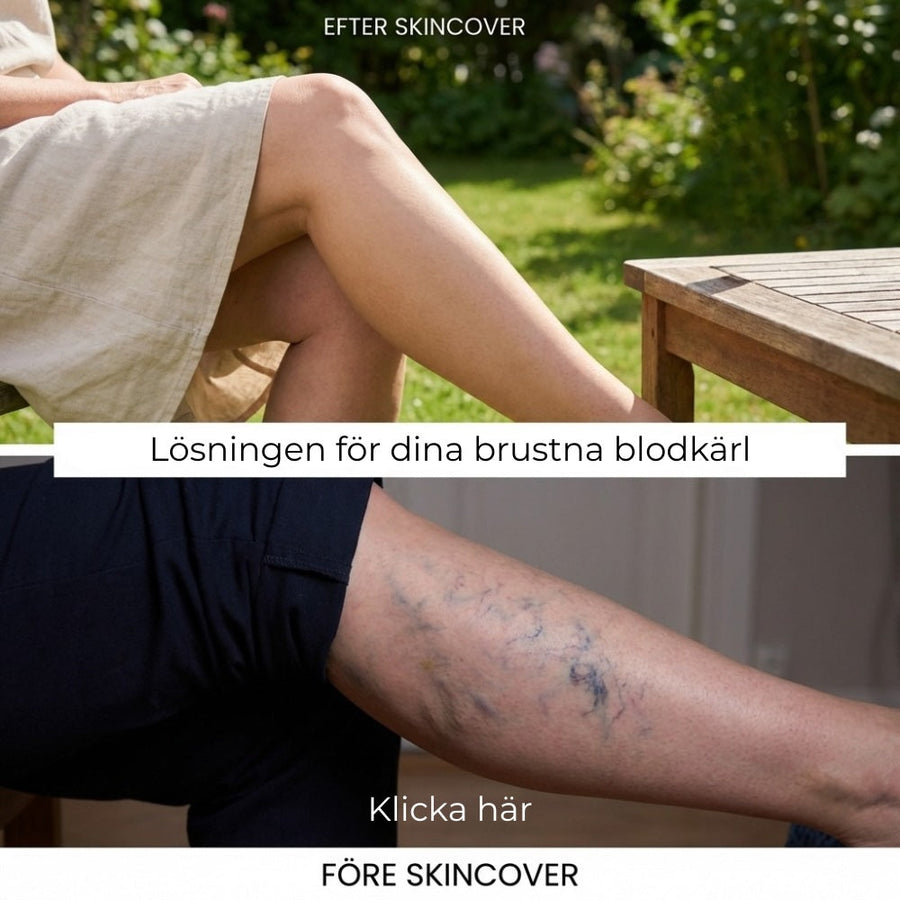 Så ser det ut på ekte hud